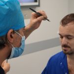 Hair Transplant in Turkey-What To Expect