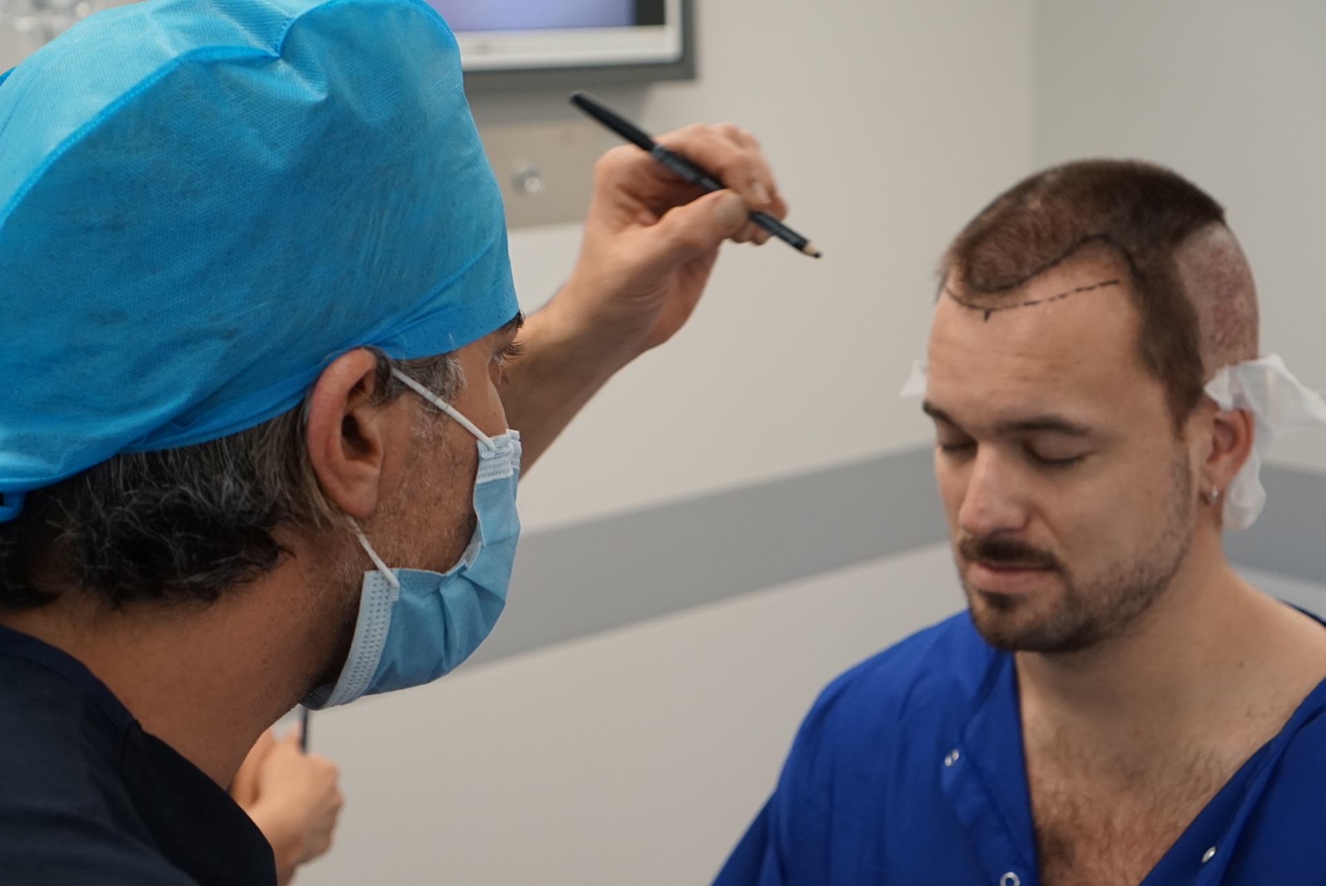 Hair Transplant in Turkey-What To Expect