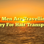 Why Men Are Travelling to Turkey For Hair Transplants