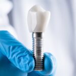The Truth About Dental Implants Abroad