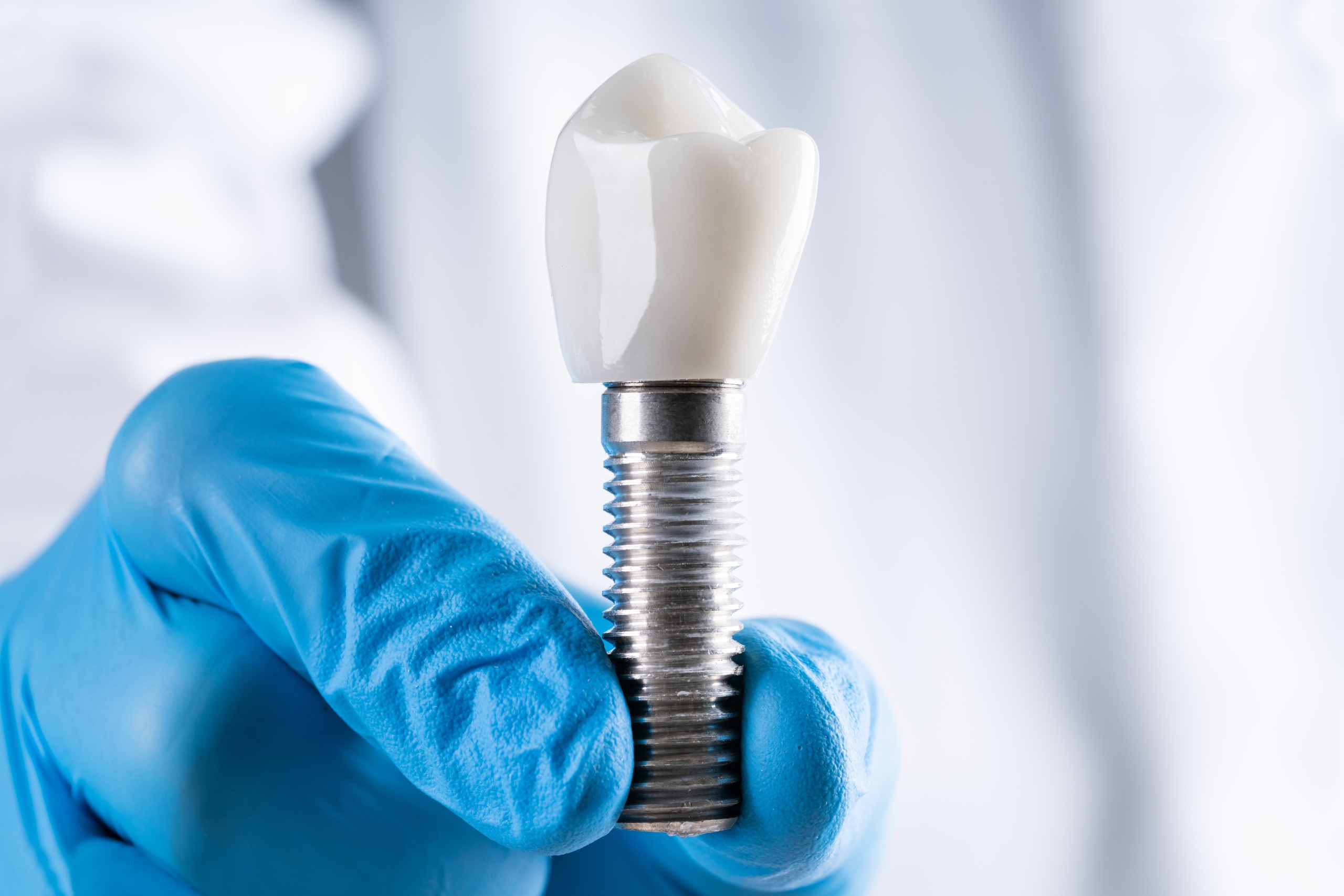 The Truth About Dental Implants Abroad