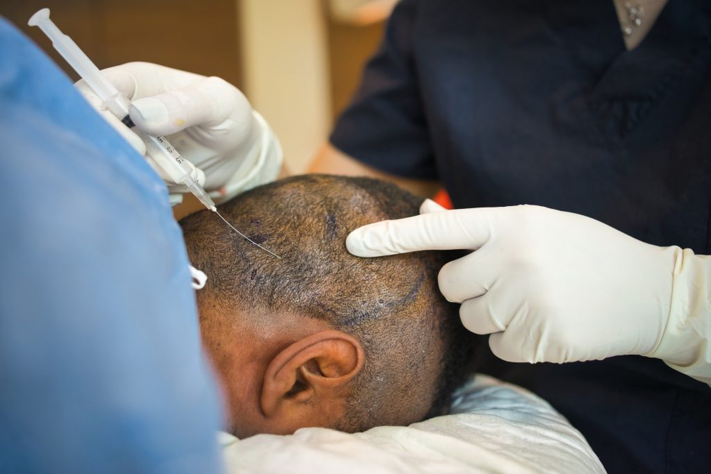 hair transplant price in turkey